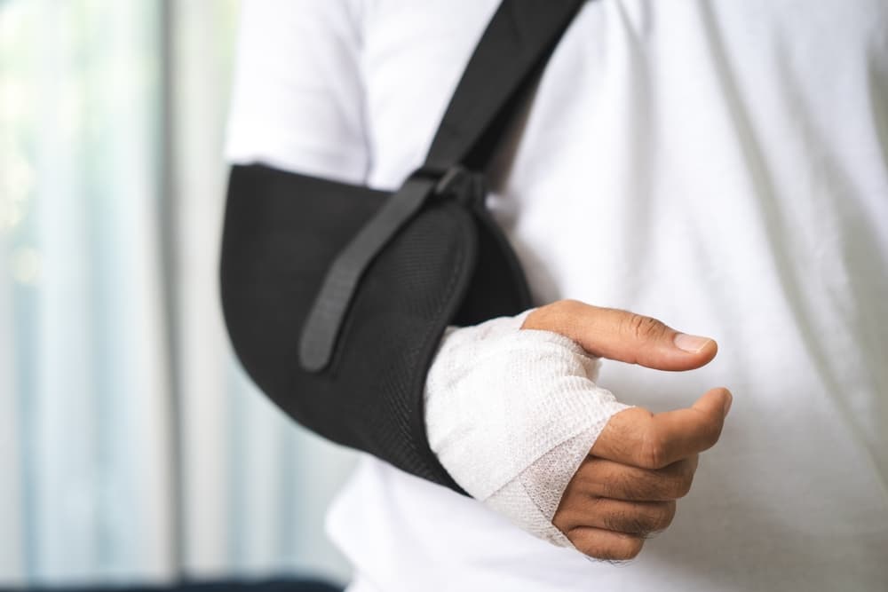 Young man with arm in cast and sling suffering from pain due to an accident, illustrating social security and health insurance concepts.